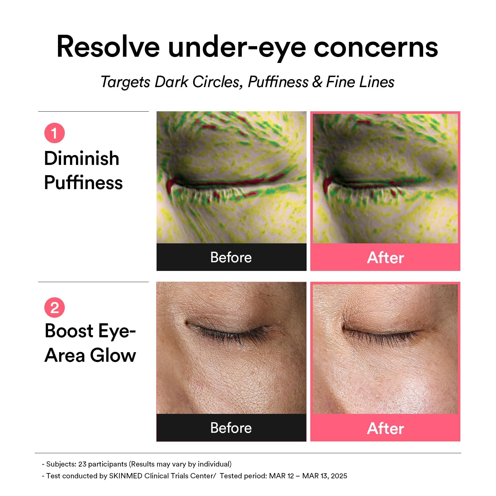Abib PDRN Retinal Firming Duo: PDRN Retinal Eye Patches with Glow Jelly, 60 Count & PDRN Volume Fill-It Booster Cream1.01 fl oz | Eye Patches and Peptide Retinal Cream for Forehead, Smile Lines, Neck - Image 4